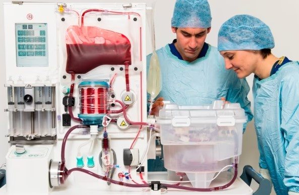 OrganOx acquired by Terumo in landmark $1.5bn deal